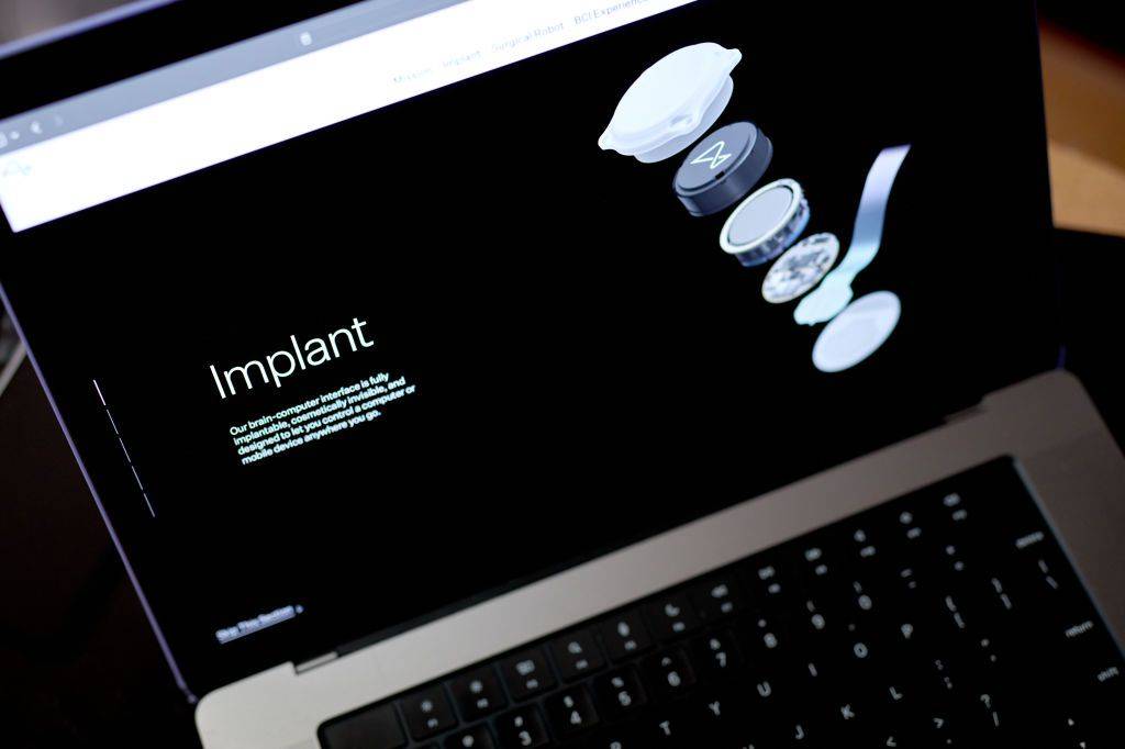 Control a Computer With Your Thoughts! Neuralink to Implant Brain Chip in Second Patient