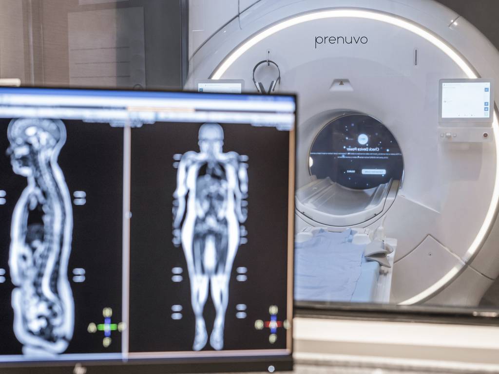 Celebrities and Influencers Are Getting $2,000 Whole-Body MRIs. Should You?